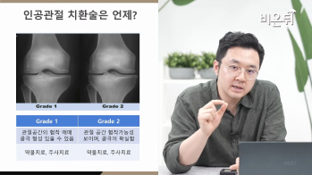 [방송/유튜브 의학채널 비온뒤] 관절염과 인공관절 수술